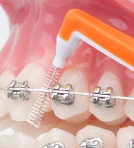 cepillo-interdental